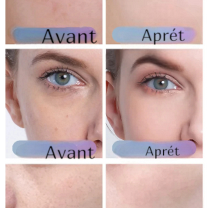 Masque LED Luminothérapie Silicone 7 Couleurs - Anti-Âge Rajeunissement