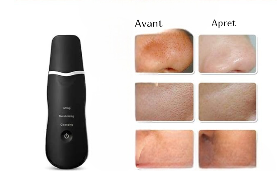 Appareil de Nettoyage Facial Ultrasonique - Éliminateur de Points Noirs et Pores - Gommage Visage Rechargeable