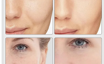 Thérapie LED Photonique 7 Couleurs pour le Visage"