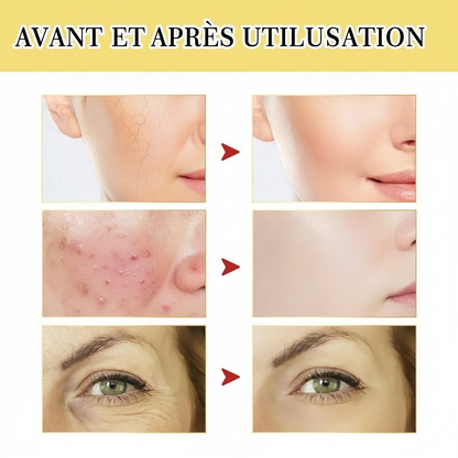 Avant et Après Utilisation