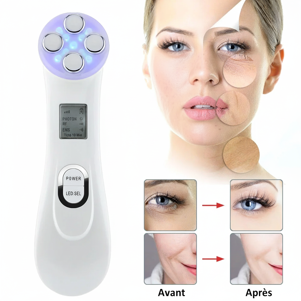 Résultats Avant Après