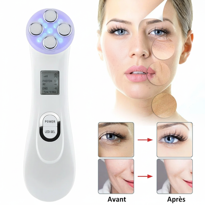 Résultats Avant Après